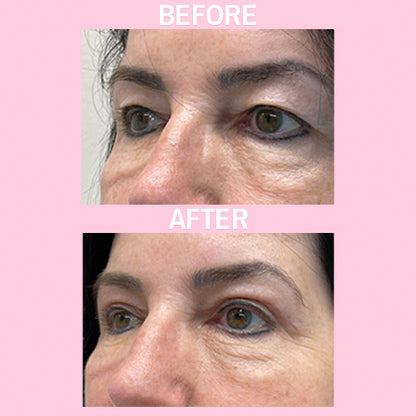 Retinal + Ginseng Eye Cream
